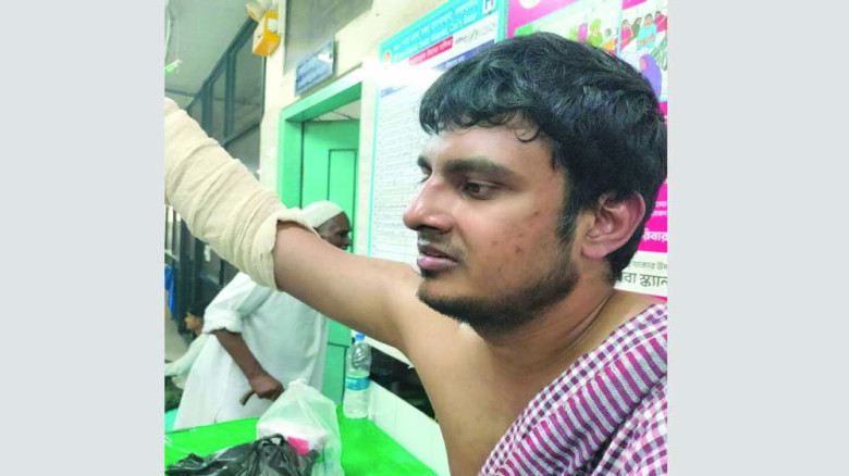 ইনানীর রিসোর্টে আগুন: প্রাণ বাঁচাতে ছাদে লাফ দিলেন চিকিৎসক দ